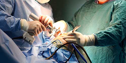 Surgical Power Tools
